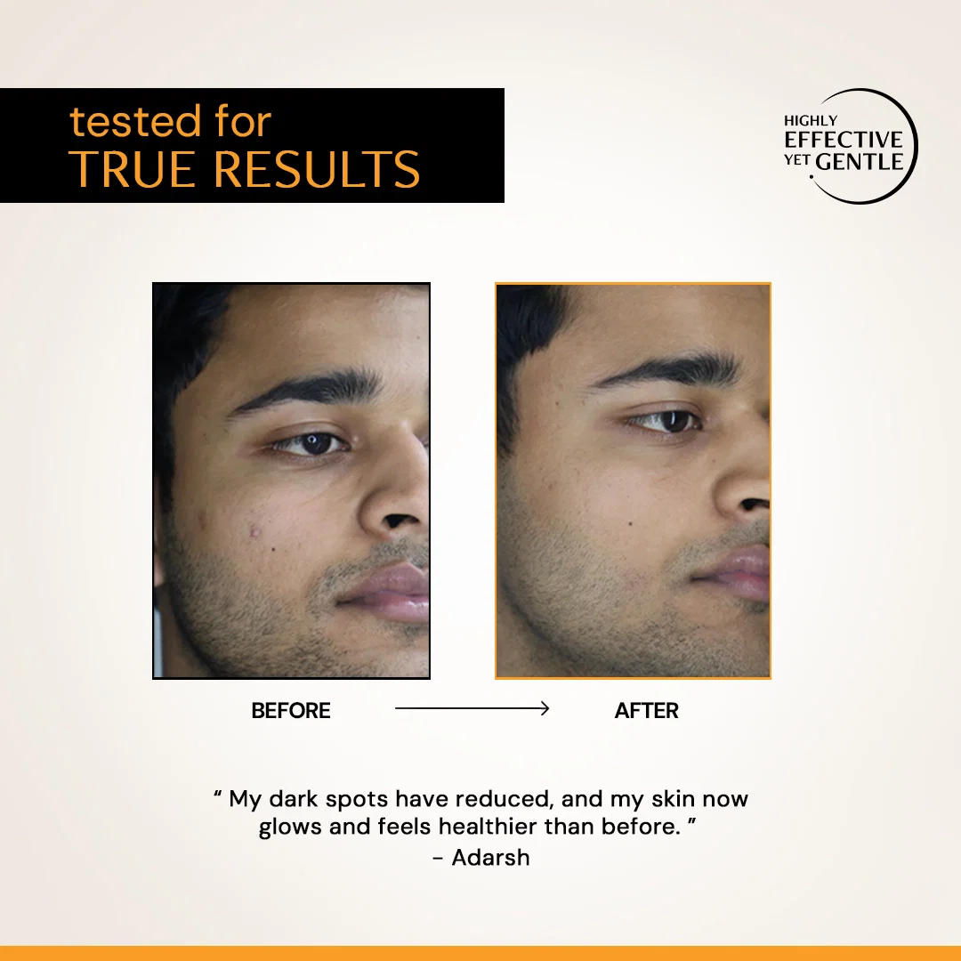 10% Vitamin C serum to reduce tanning and Dullness | Clinically Tested, Non-Irritating| Brightens & Evens Tone | For Oily Skin - Image 17