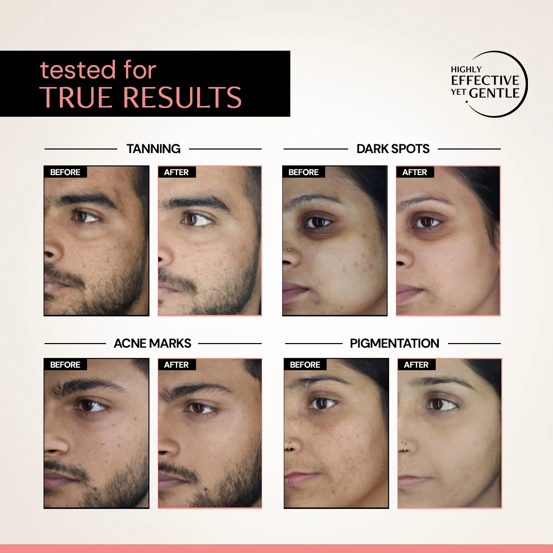 Clearing Serum with 5% Niacinamide & 2% Alpha Arbutin | Clinically Tested - Image 6