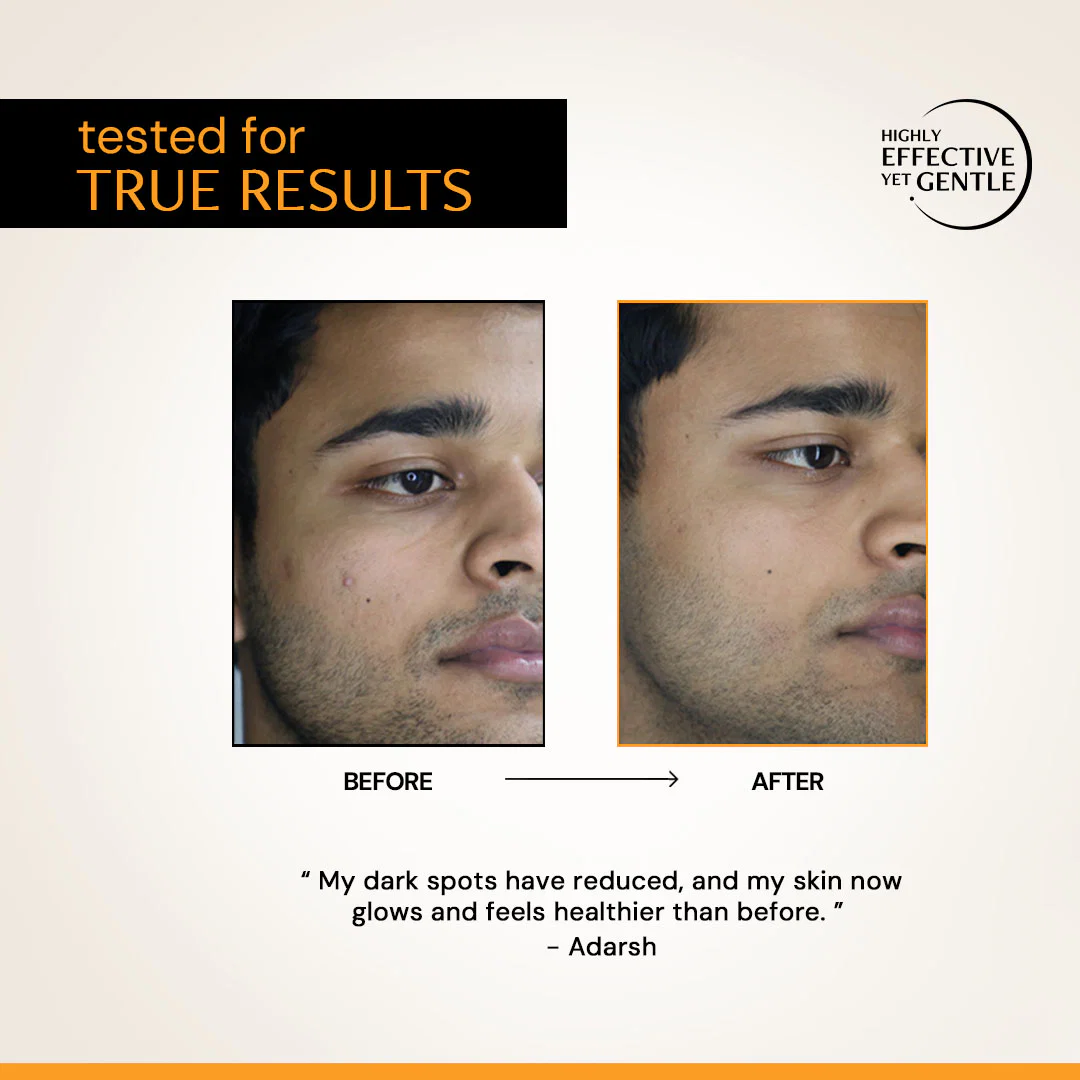 10% Vitamin C serum (10ml)| Clinically Tested, Non-Irritating| Brightens & Evens Tone | For Oily Skin - Image 7