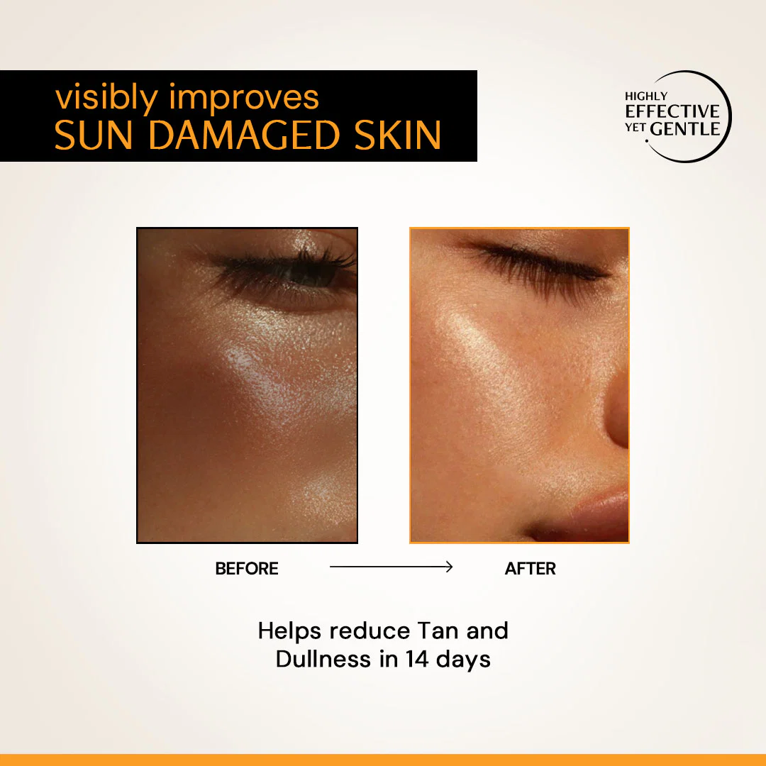 10% Vitamin C serum (10ml)| Clinically Tested, Non-Irritating| Brightens & Evens Tone | For Oily Skin - Image 8